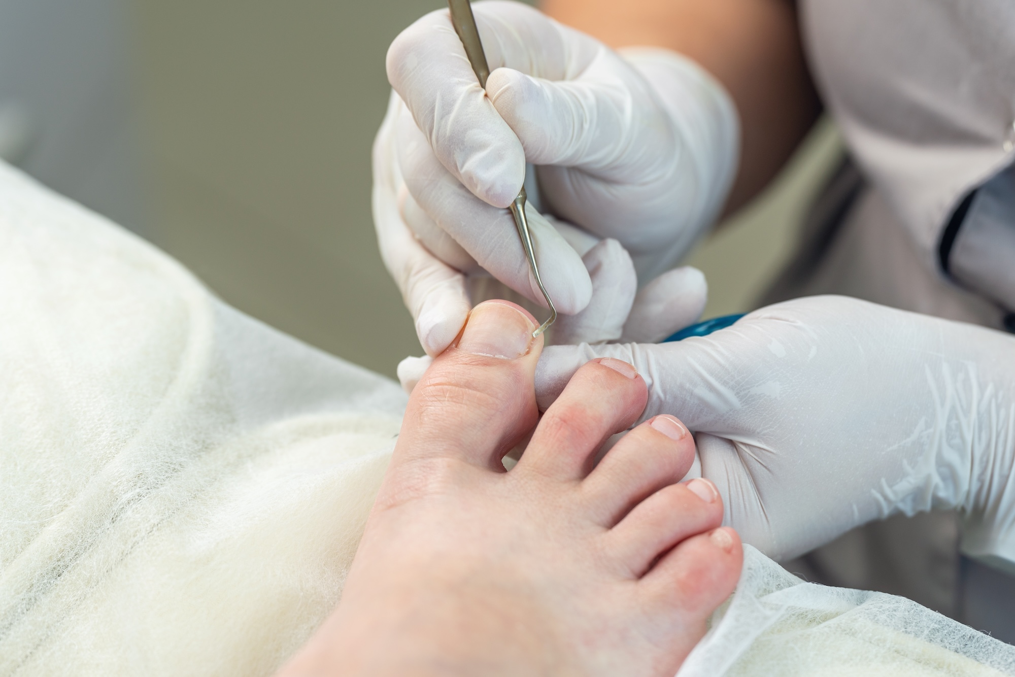 Medizinische Fußpflege Zirndorf