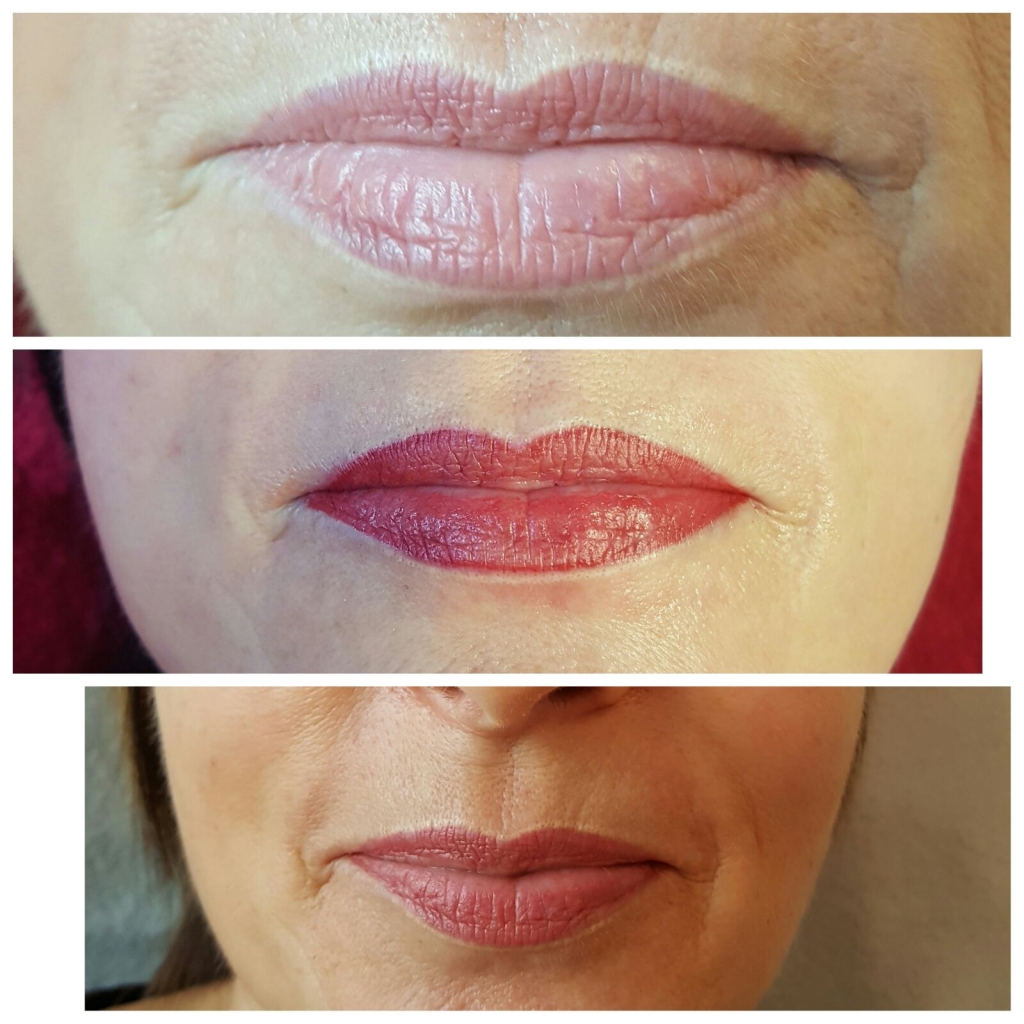 Vorher Nachher Permanent Make Up Lippen  Neunkirchen / Wemmetsweiler Saarland