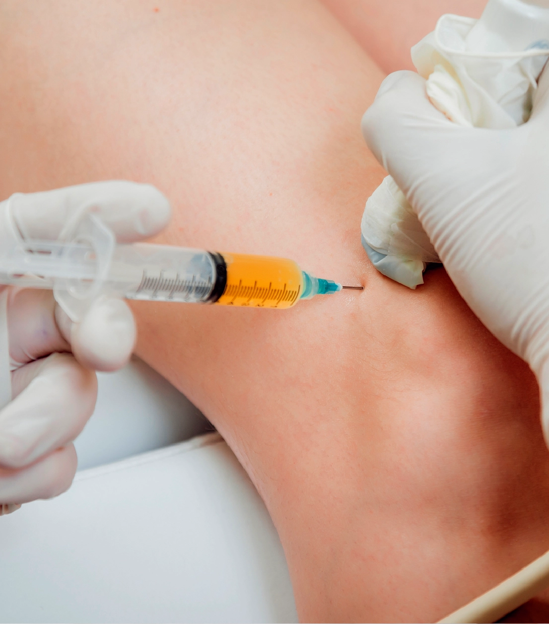 Hyaluronsäuretherapie