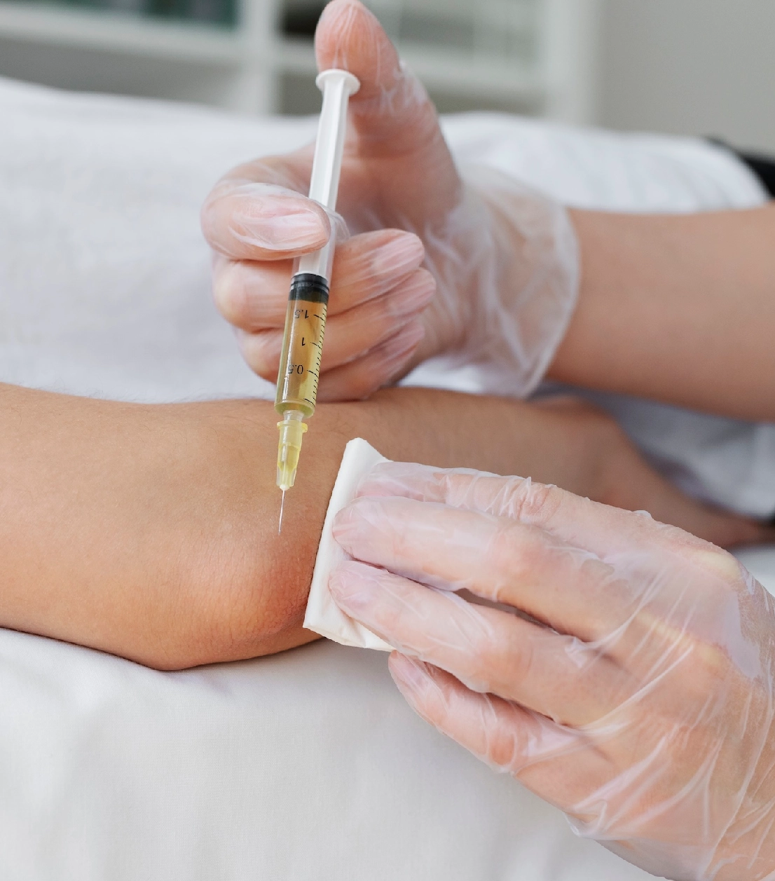 Kombinierte Eigenbluttherapie / ACP