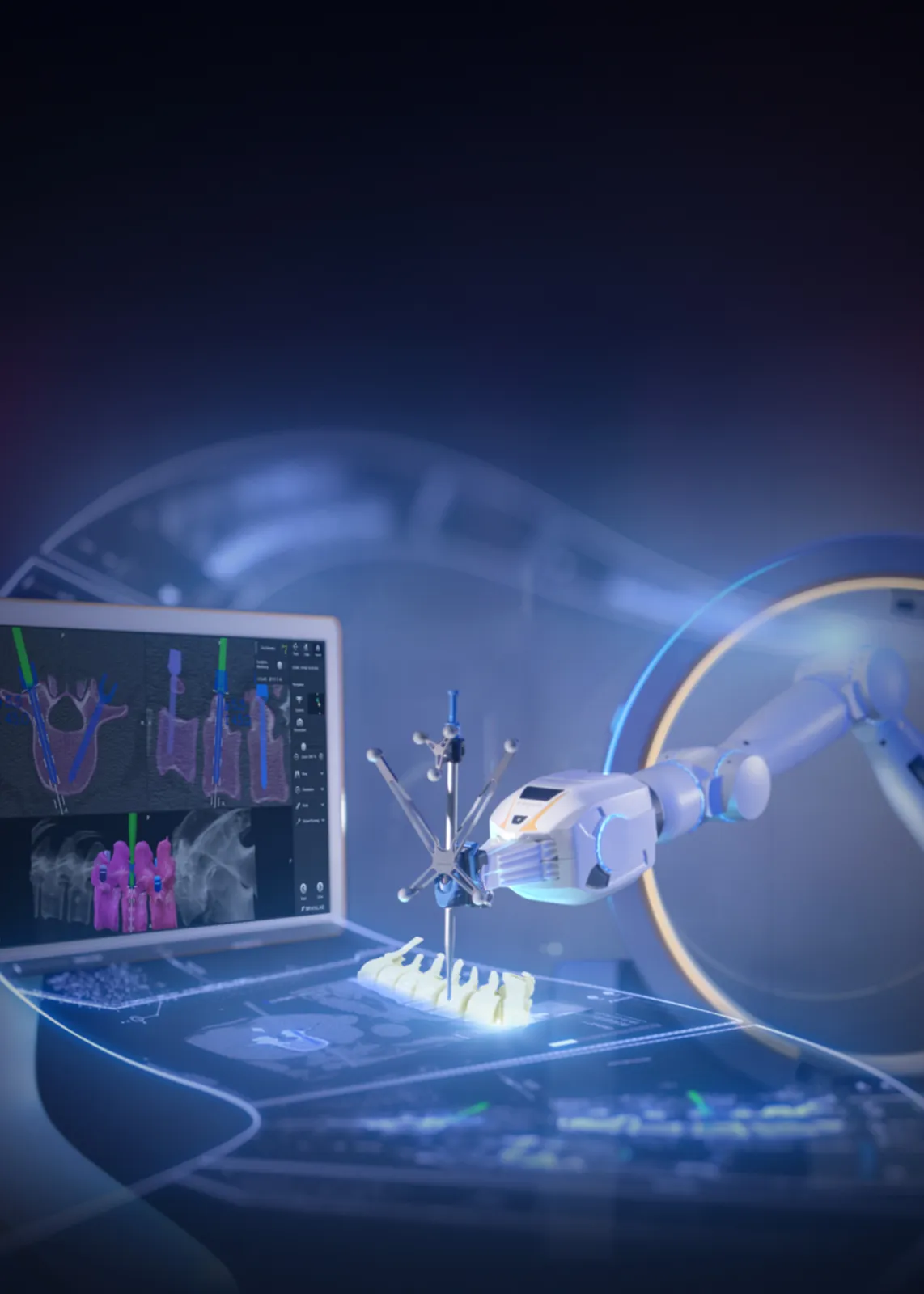Brainlab Robotic Suite im Operationssaal