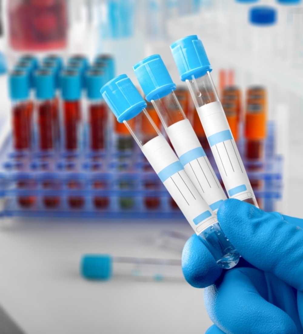 Labordiagnostik