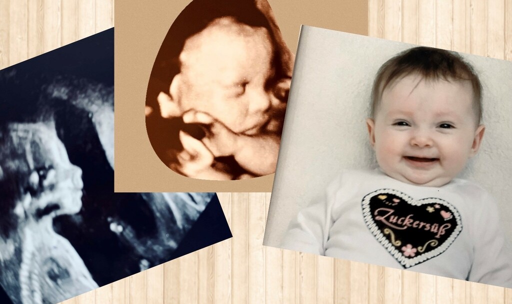 Drei Bilder von einem Baby