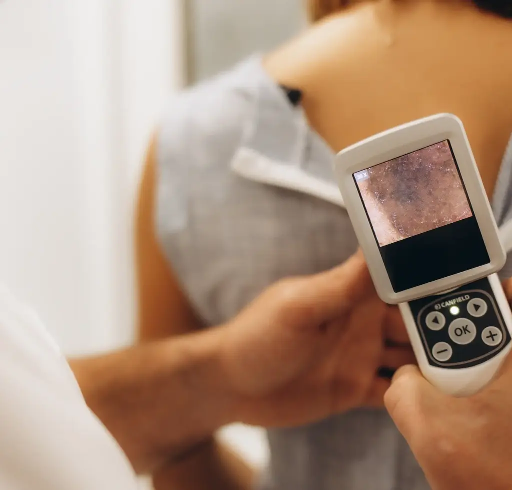 Muttermal von Patient wird mit Gerät überprüft