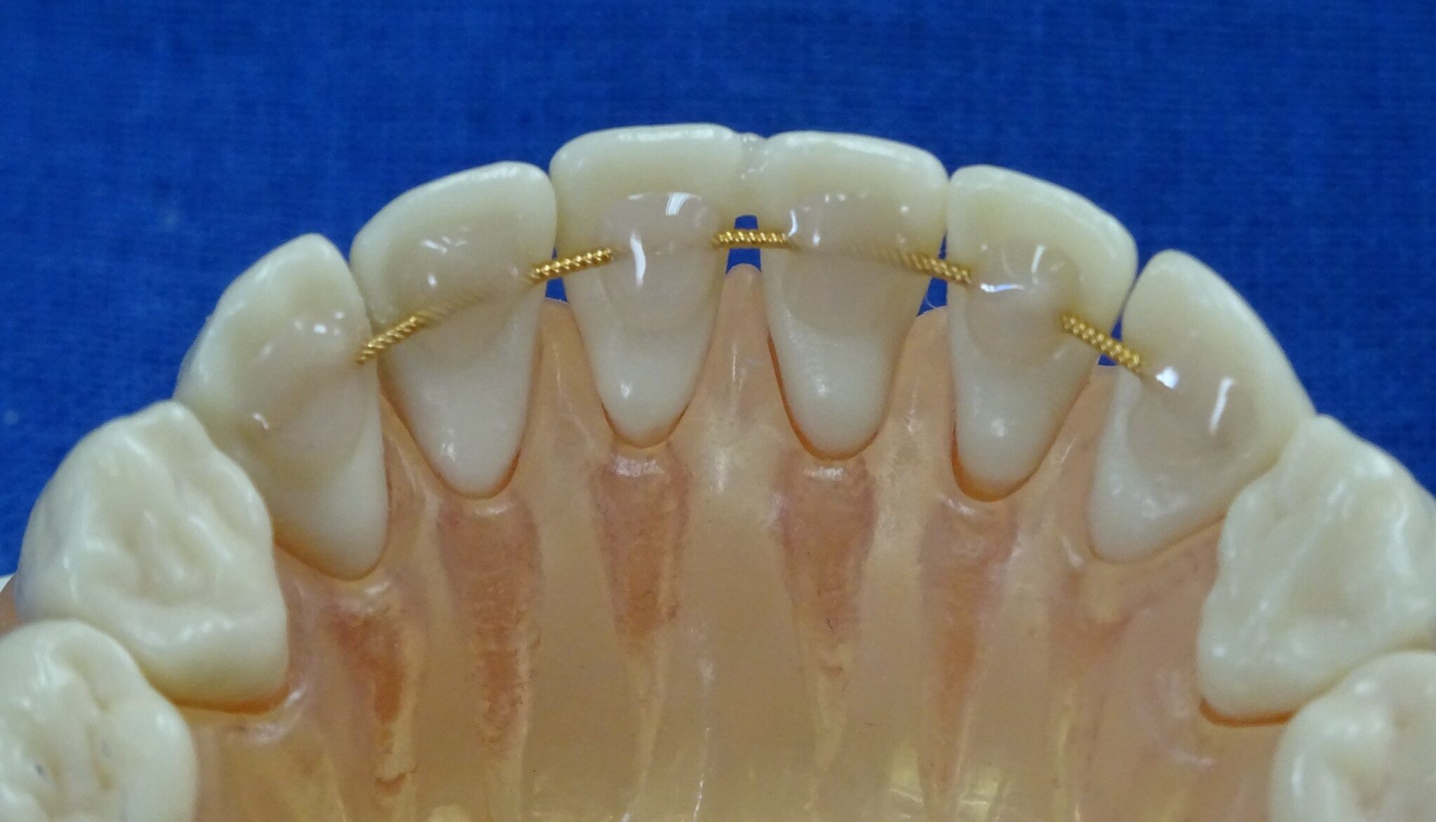 Foto von einer Retentionmöglichkeit