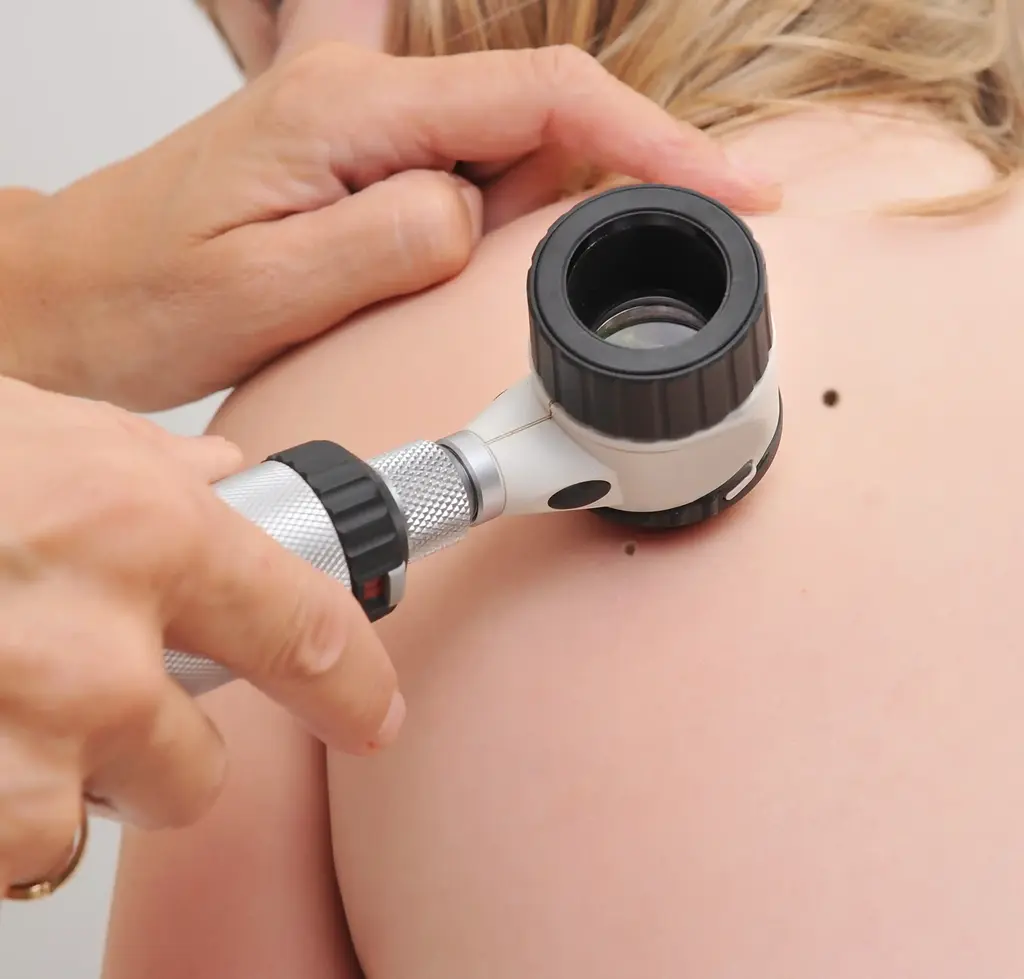 Leberflecken am Kinderrücken werden von Arzt untersucht