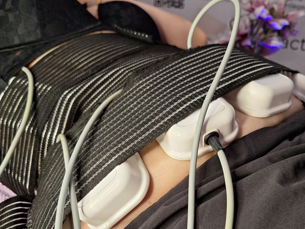 Tretman za eliminaciju toksina i zadržane vode iz tela – MYA PRO aparat