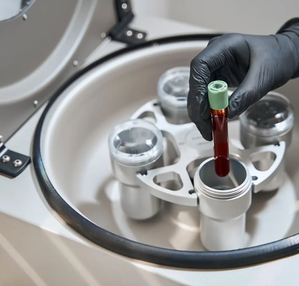 Eigenbluttherapie per Ampulle