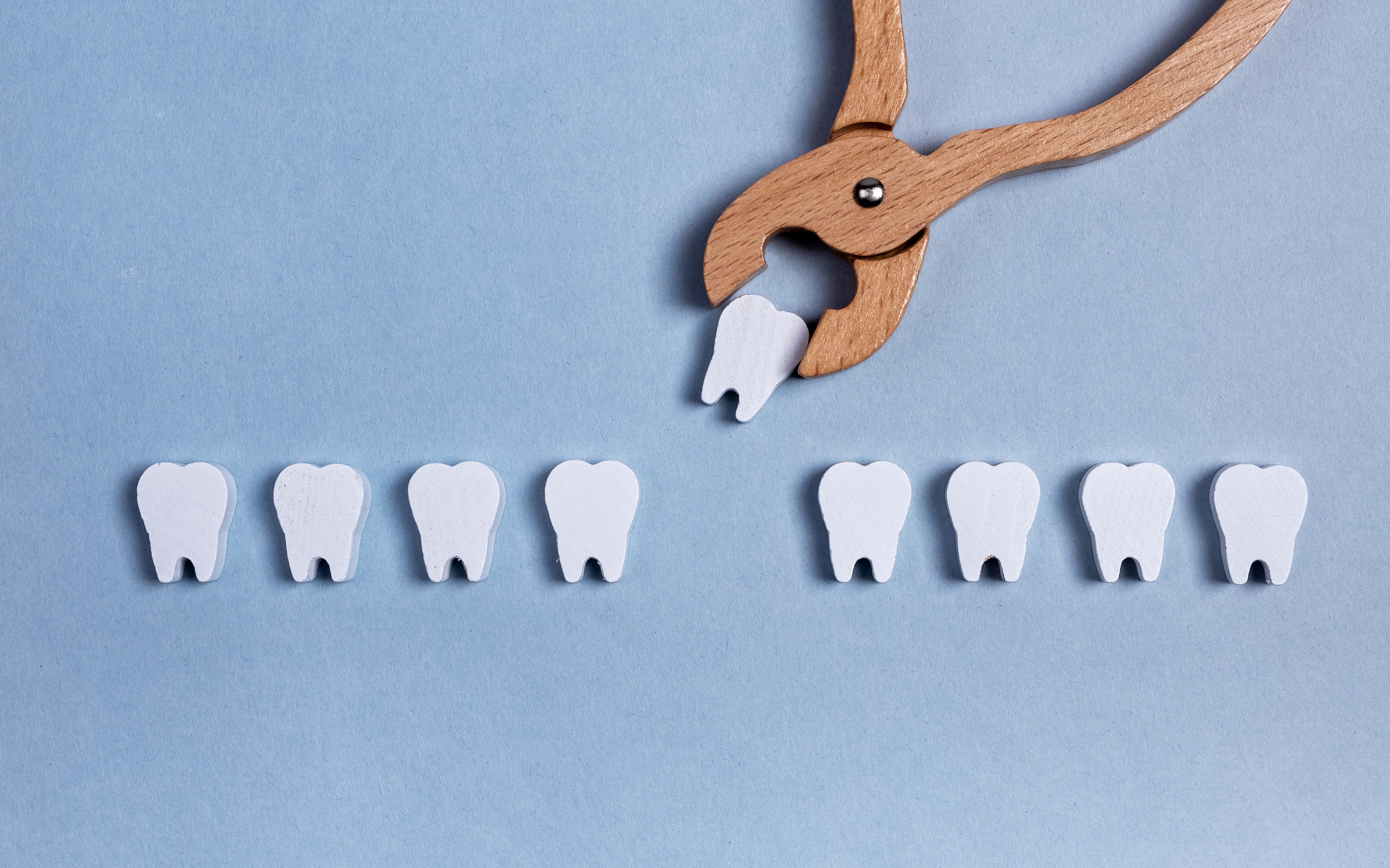 Weisheitszahnentfernung