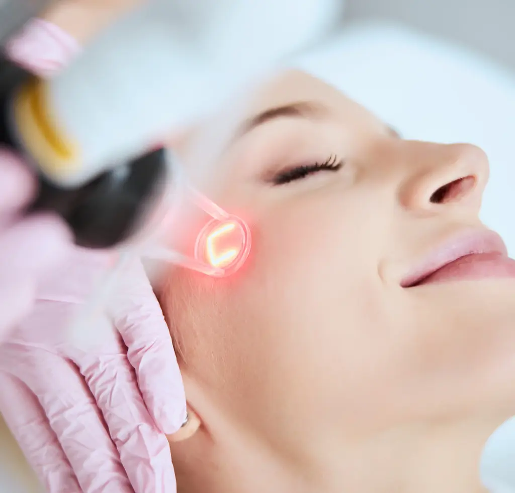 Erbiumlaser an Wange von Patientin