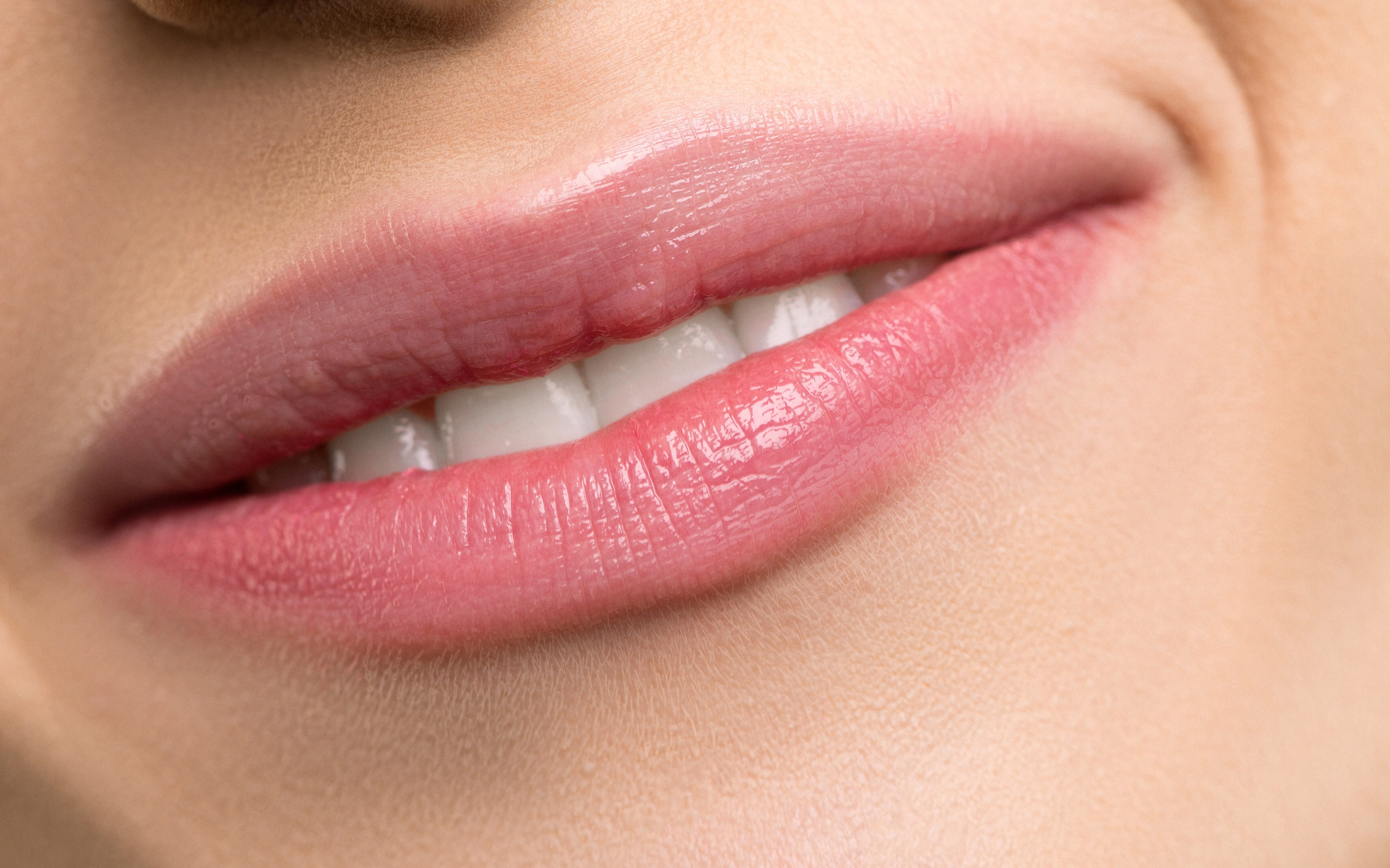 Artikelbild - Nasolabialveck & sura mungipor / Marionette