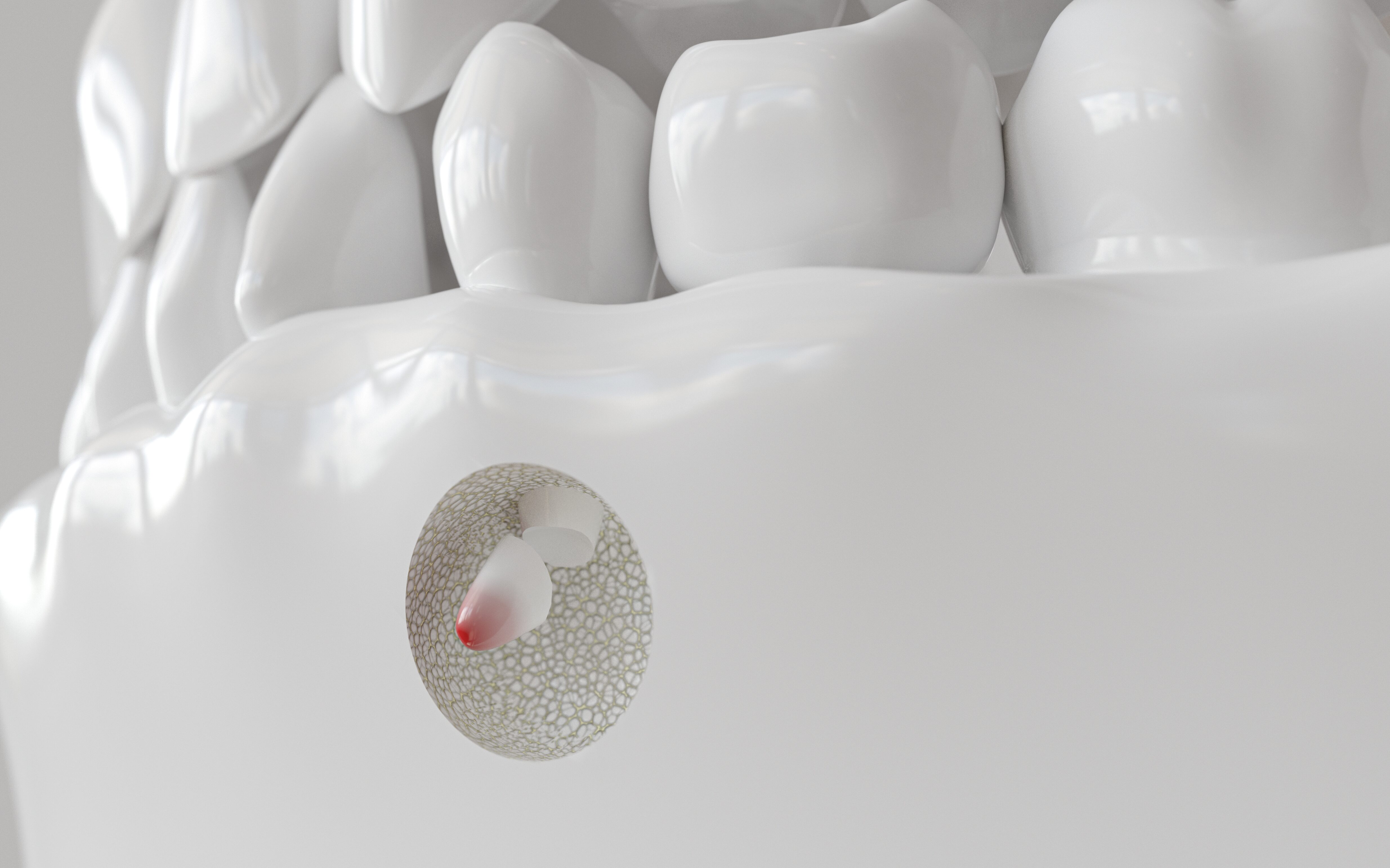 Wurzelspitzenresektion