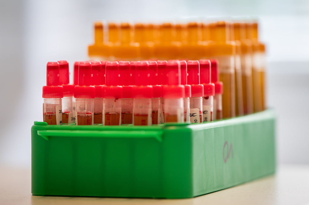 Blutproben in Röhrchen