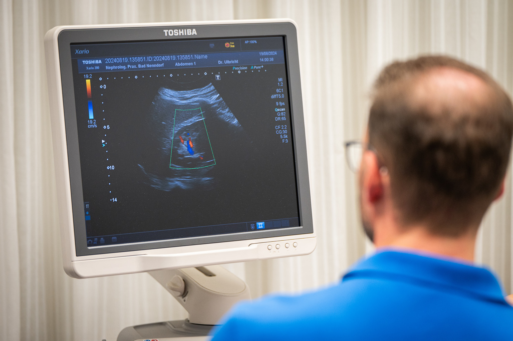Ultraschallbild auf einem Monitor.