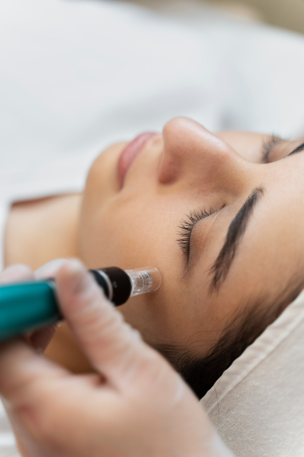SkinPen Microneedling  Leipzig