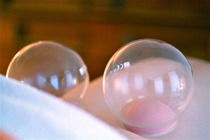 Schröpfkugeln im Einsatz