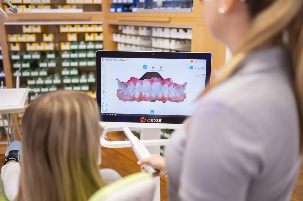 Intraoral Scanner