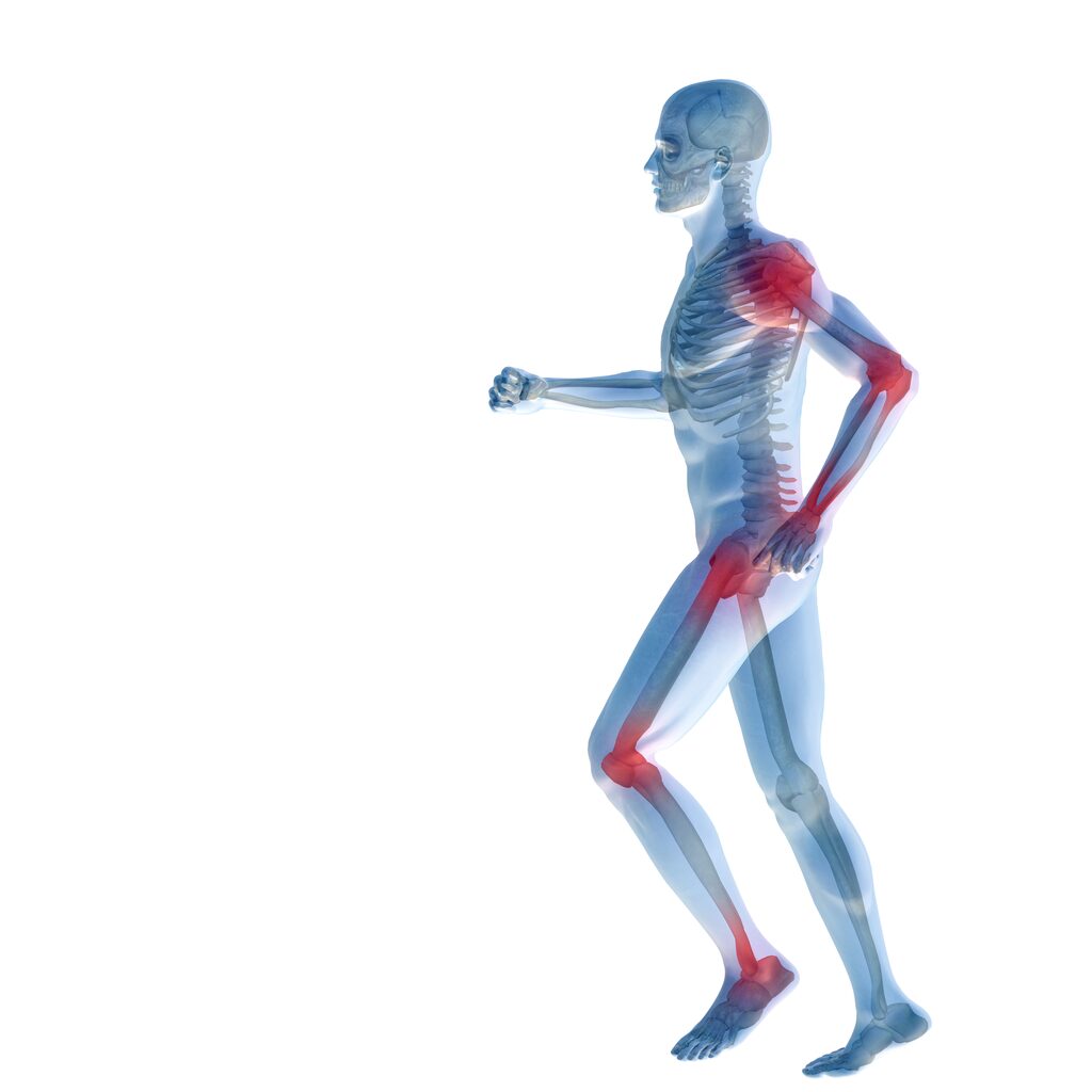 Bild eines Skeletts mit Gelenkschmerzen