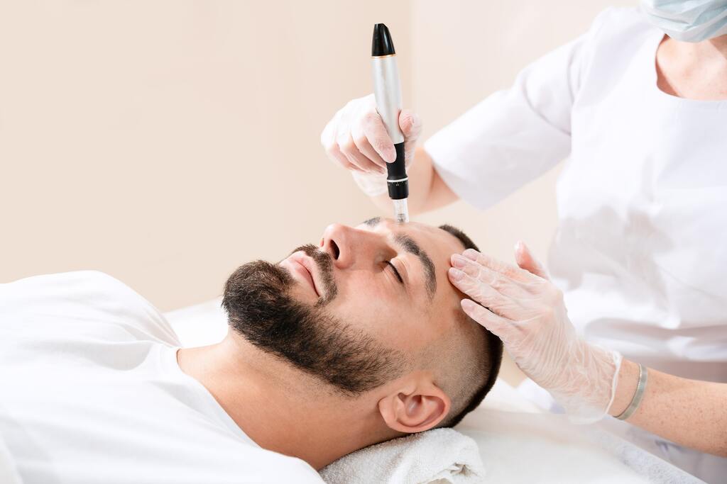 Radiofrequenz-Microneedling