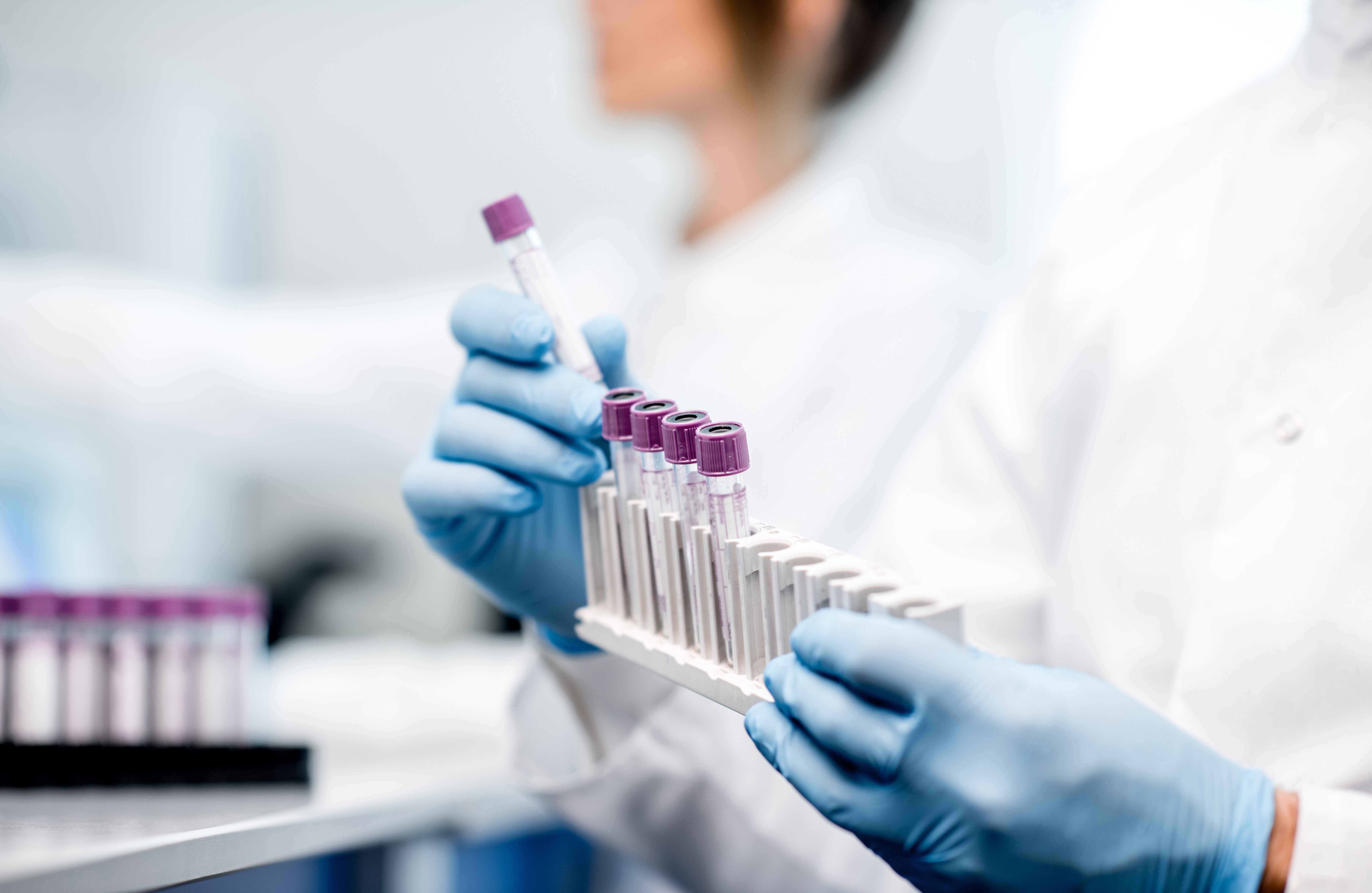 Hausärztliche Praxis Mehler in Dortmund - Laboruntersuchungen