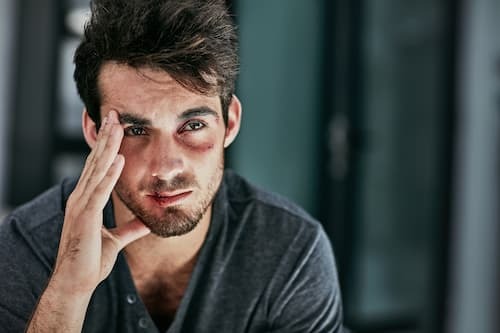 Mann mit Angststörung sieht müde aus