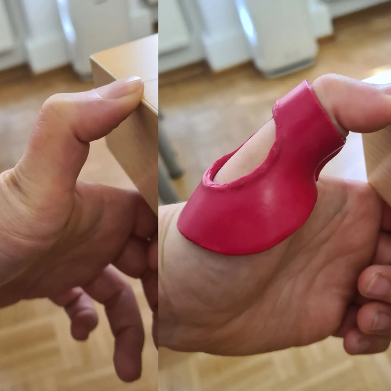 Ergotherapeutische Schienen
