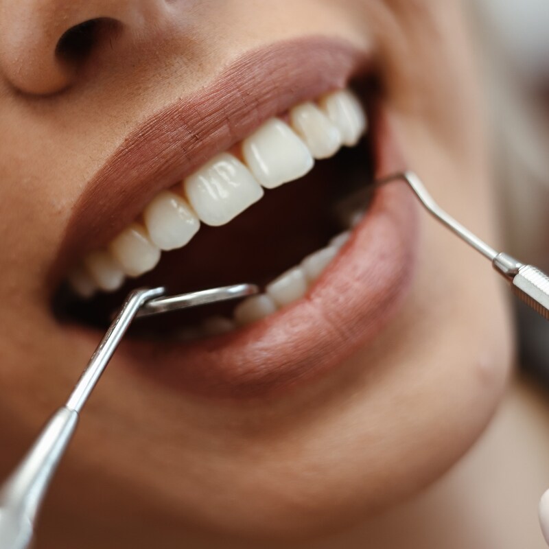 Zahnarztpraxis Prinz, Ochsenhausen - Gesunde Zähne