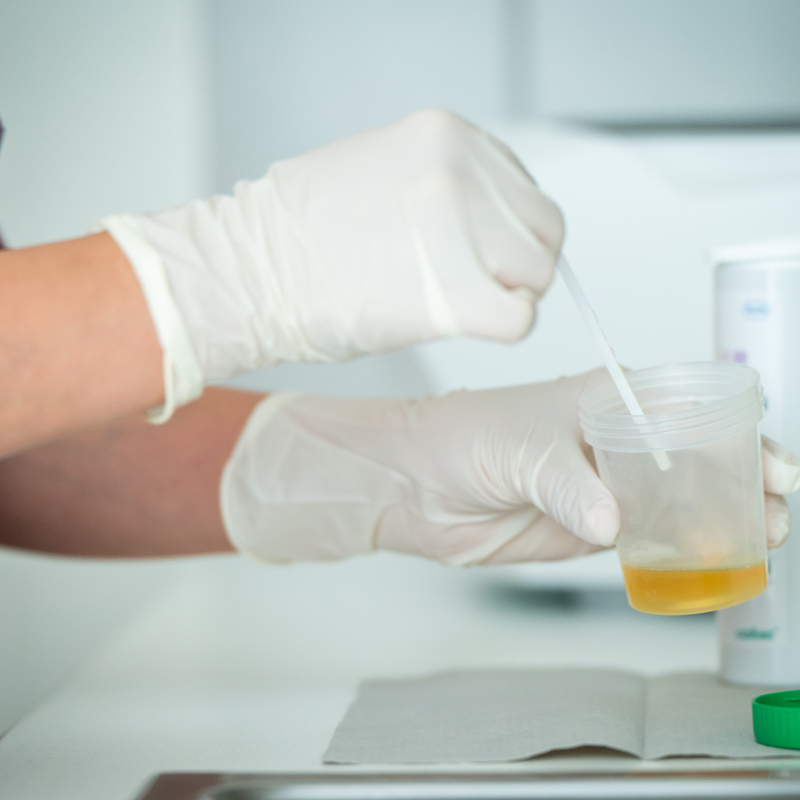 Urinprobe wird vorbereitet