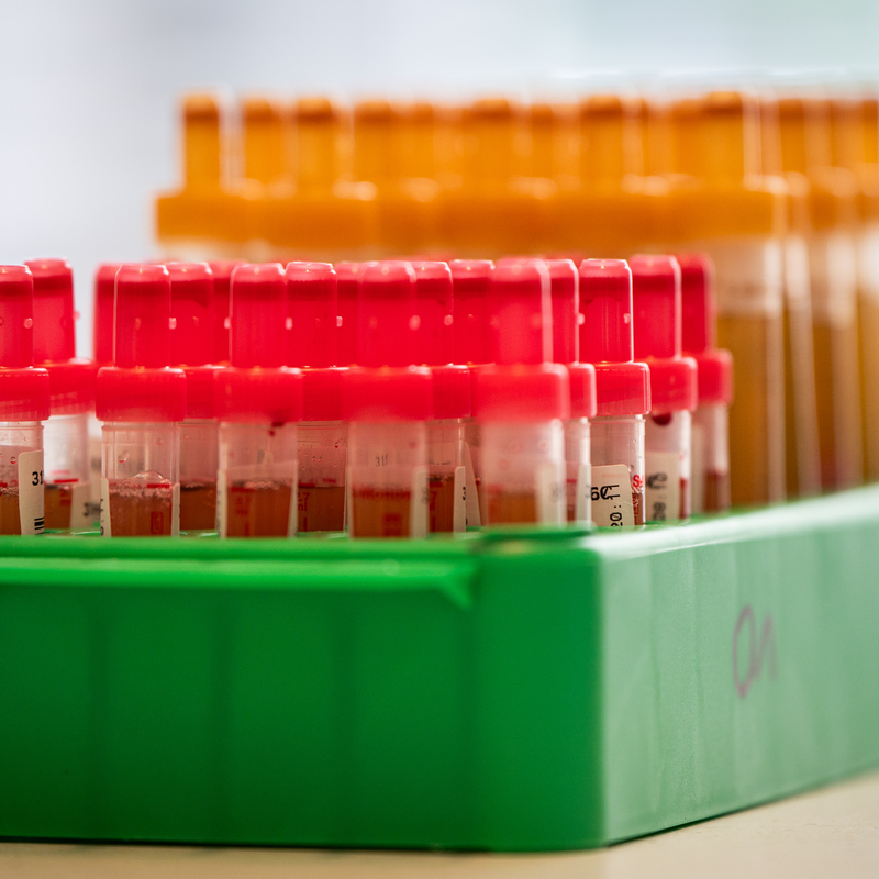 Blutproben in Röhrchen
