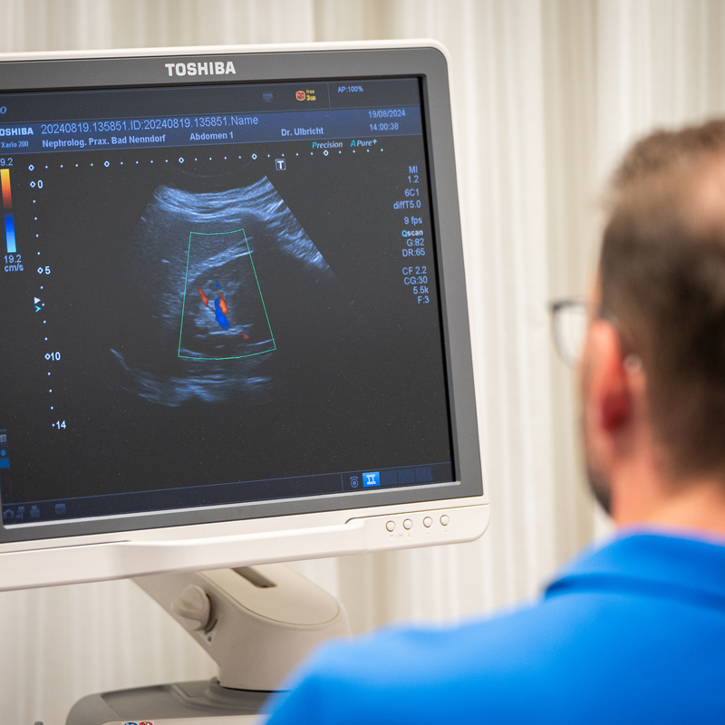 Ultraschallbild auf einem Monitor.