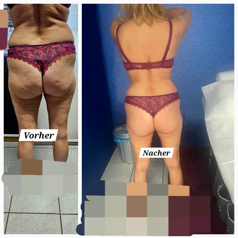 Kennenlernbehandlung Abnehmen
