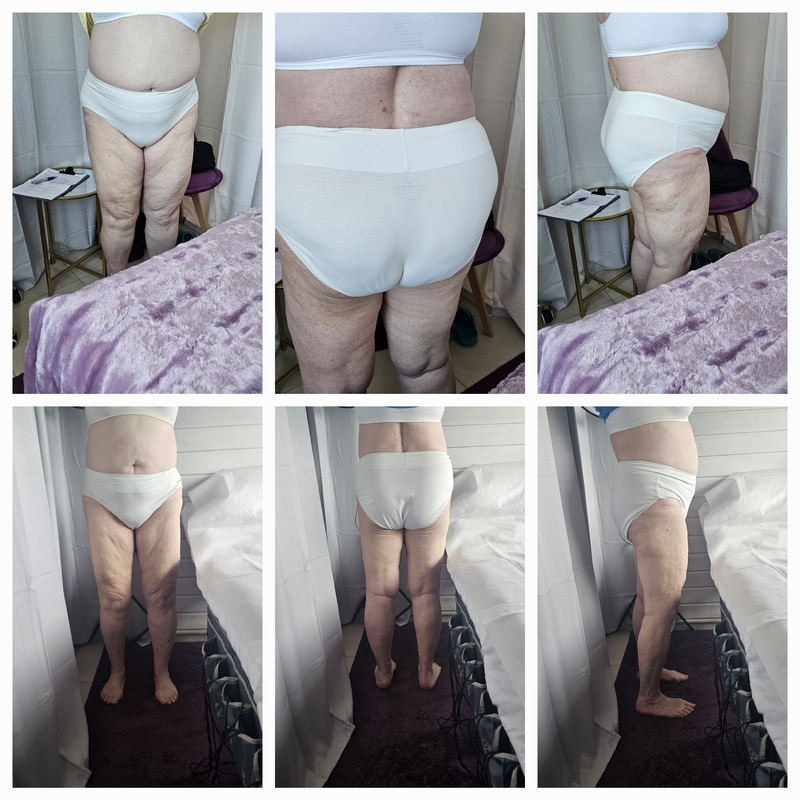 schmerzfreie Lymphdrainage
