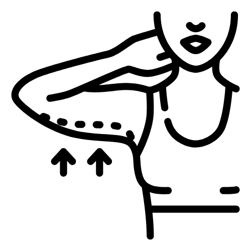 Oberarmfett entfernen mit Kryolipolyse